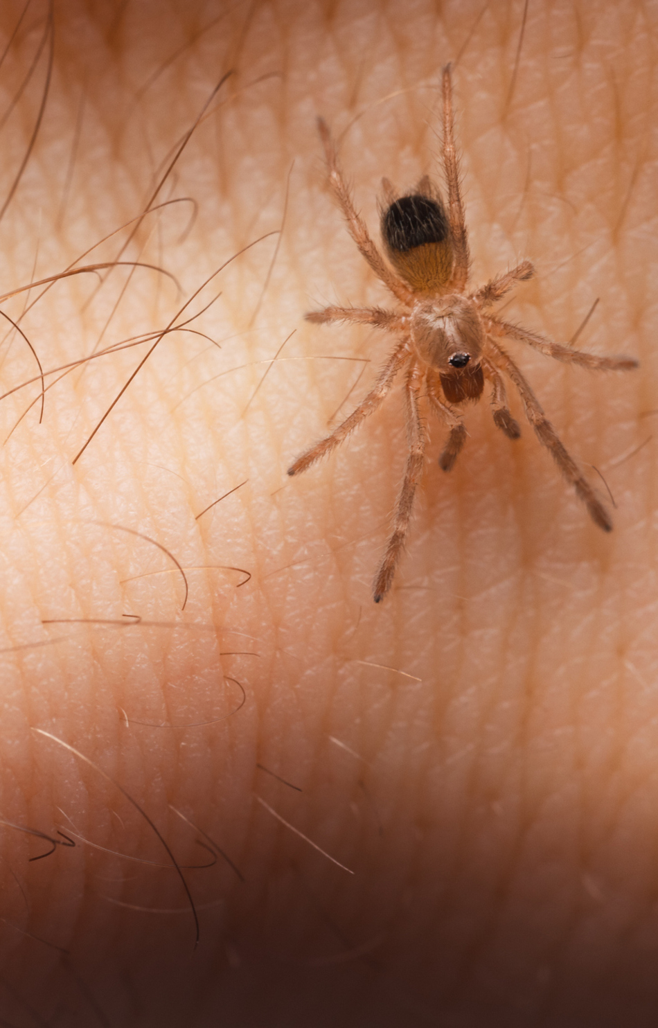Signs and Symptoms of a Poisonous Spider Bite