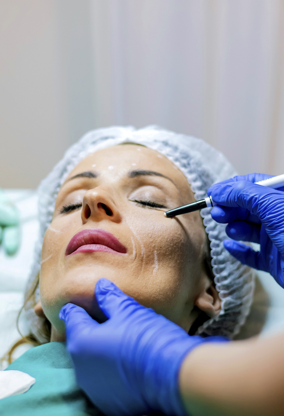 What is the Difference Between a Normal Facelift and a Mini Facelift?