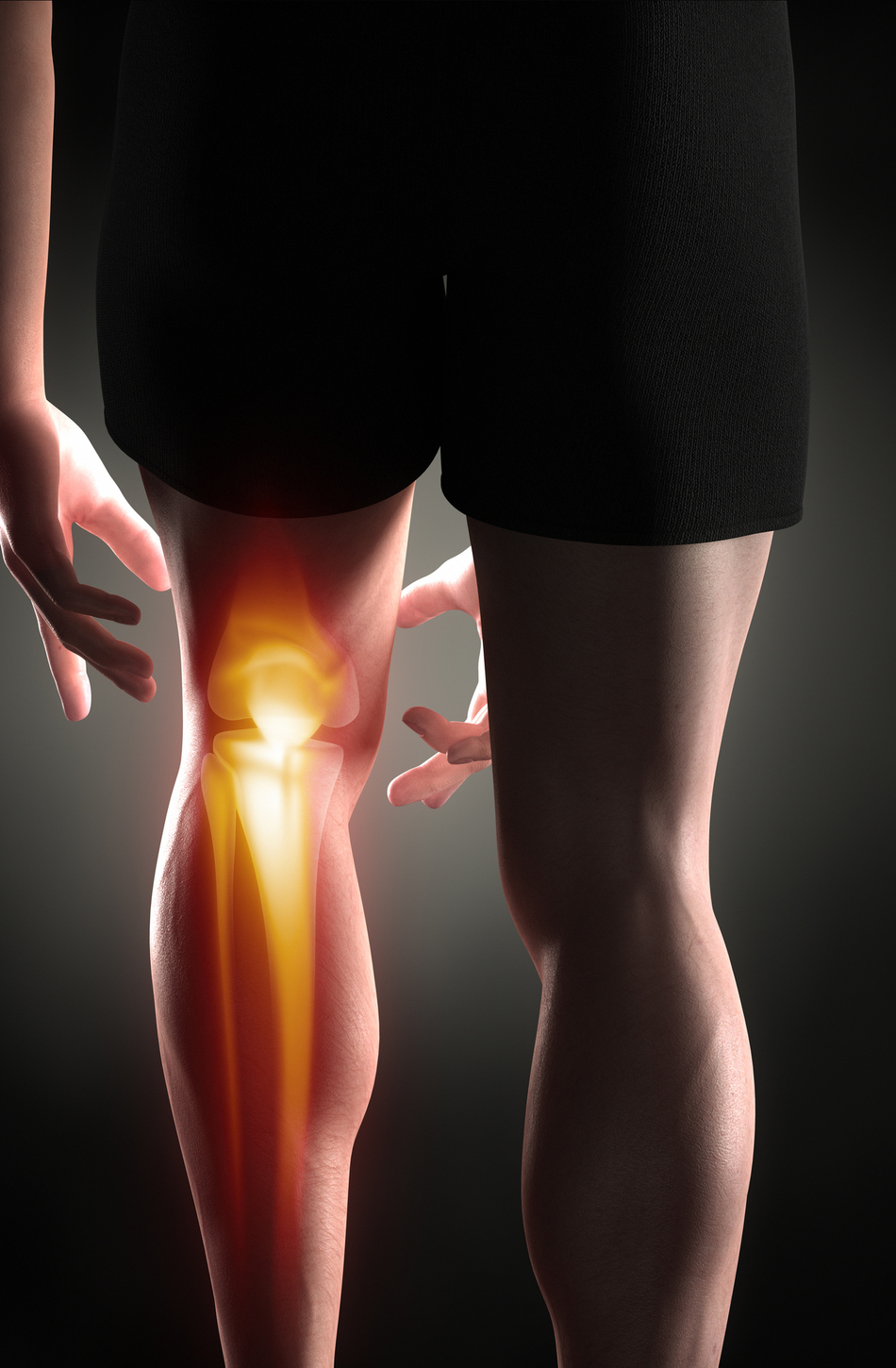 Does an ACL Injury Mean Game Over for Student Athletes?