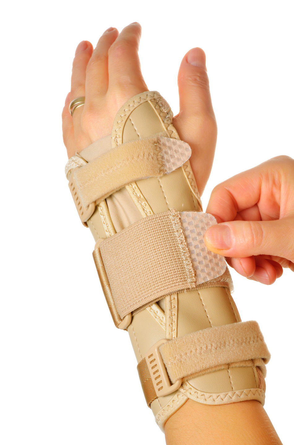 Treating Carpal Tunnel Without Surgery