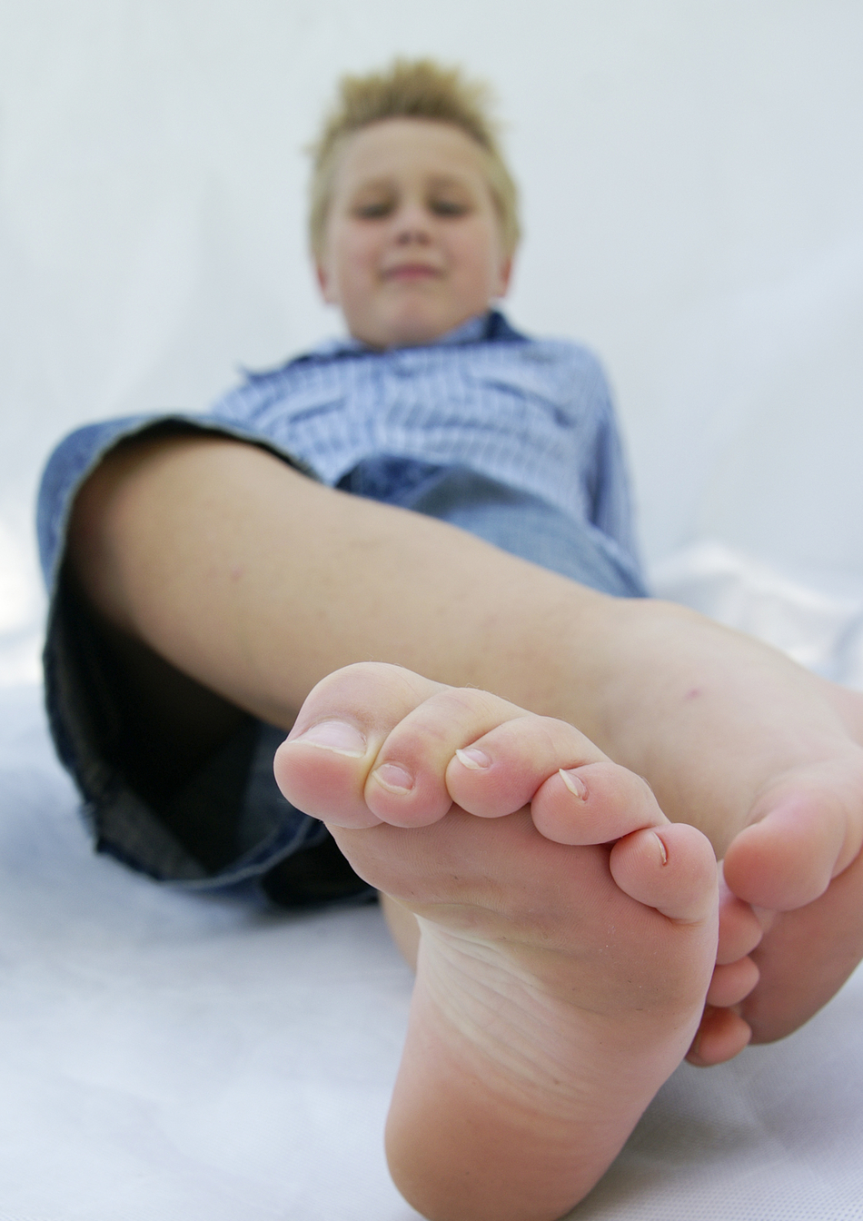 What to Do About Your Child’s Ingrown Toenail