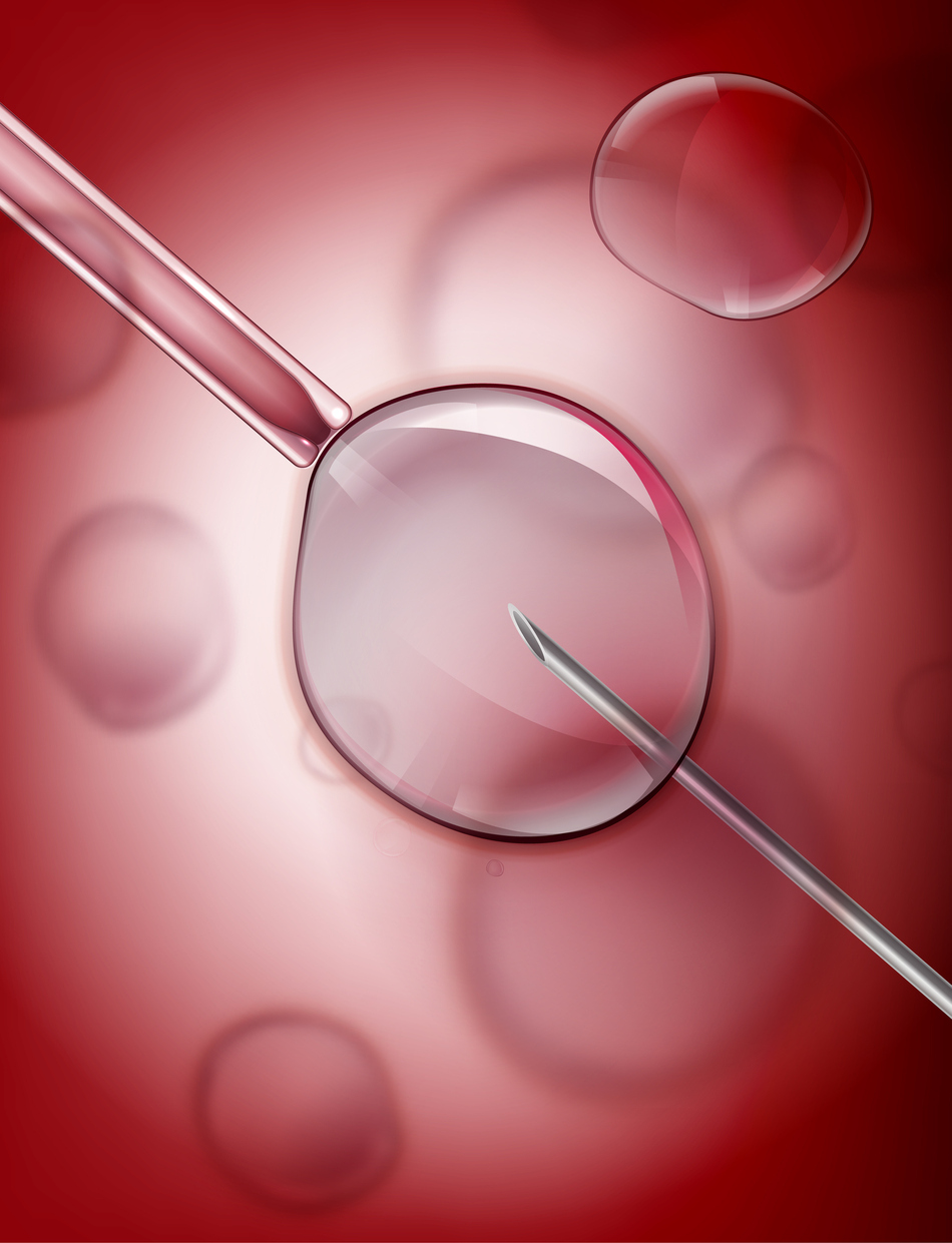 Will Endometrial Scratching Help Me Get Pregnant Through IVF?