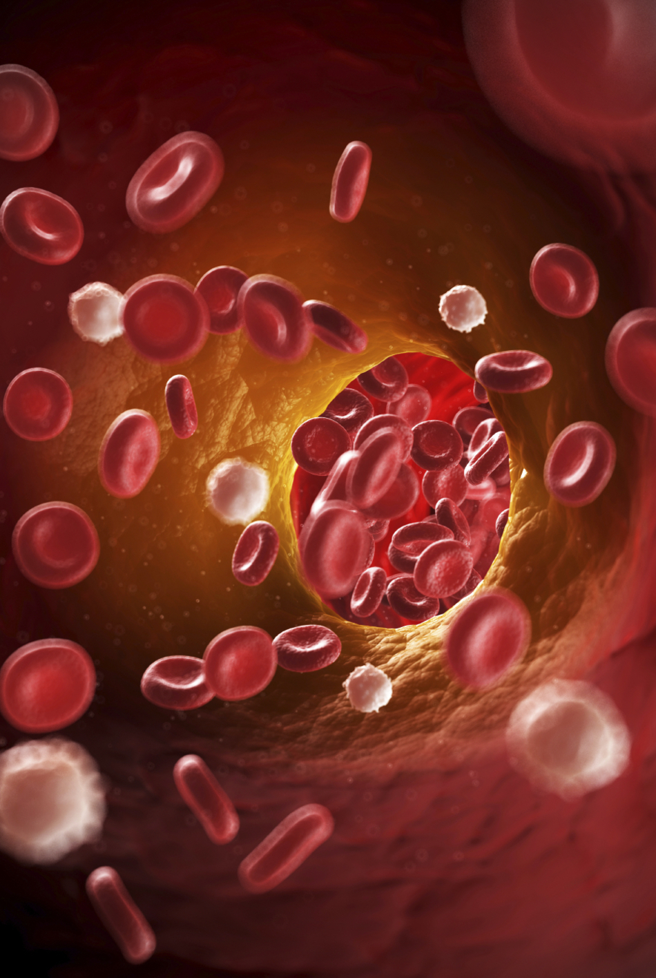 New Guidance Statements on Management of Venous Thromboembolism