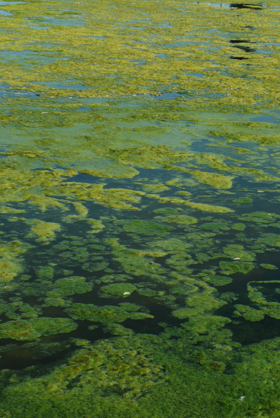 Why You Should Call Poison Control if You’ve Been Exposed to Algae Bloom Water
