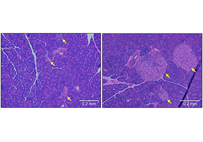 Diabetes and OCA-B