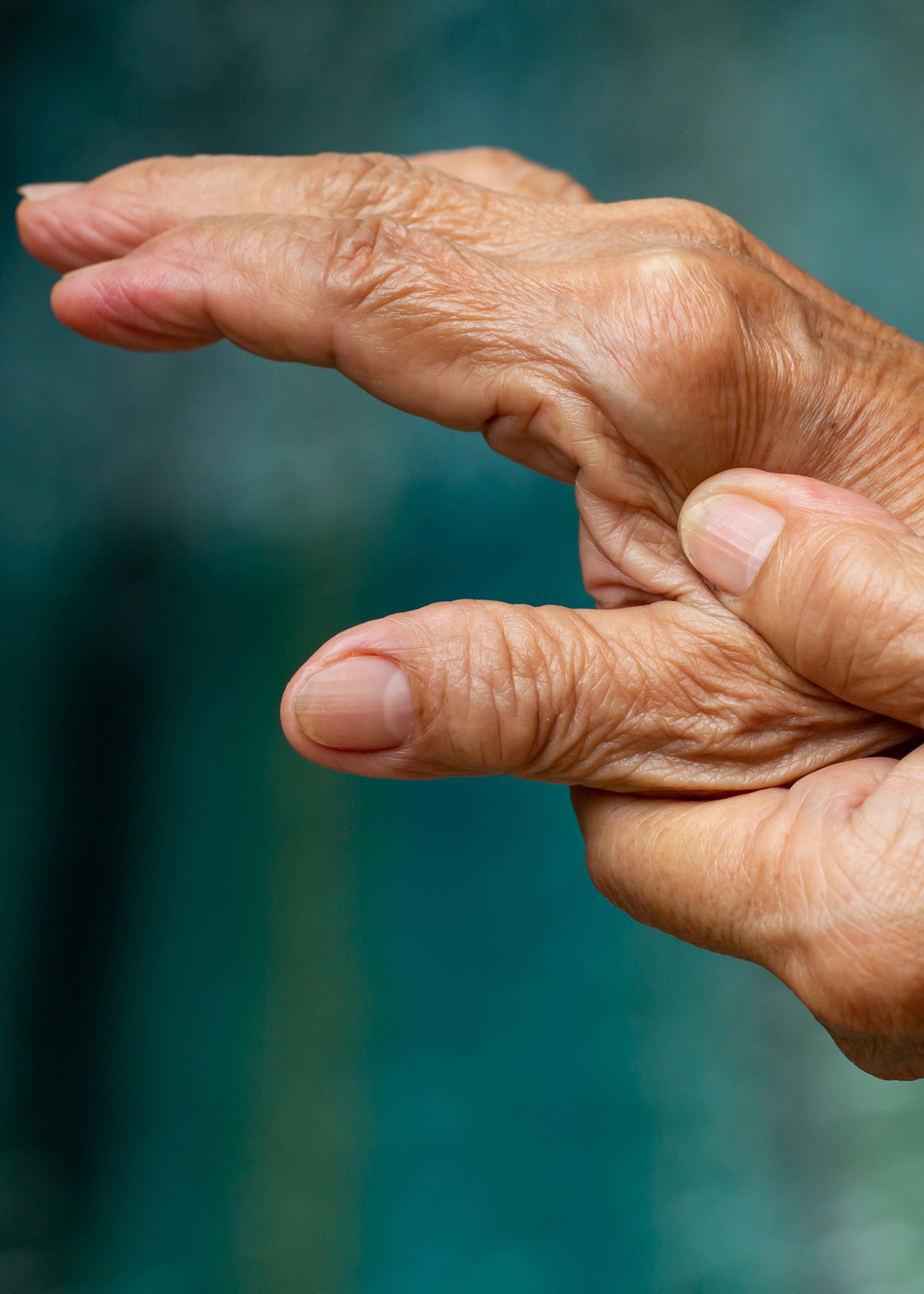 What Treatment Options are Available for Thumb Arthritis?