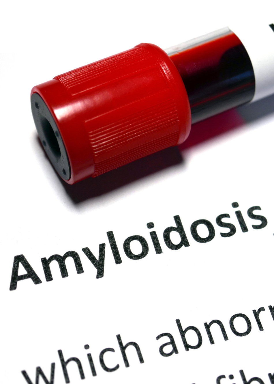 What is Amyloidosis and How is it Treated?