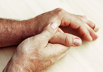 osteoarthritis in the hands