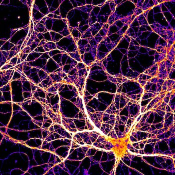 arc-neurons.jpg