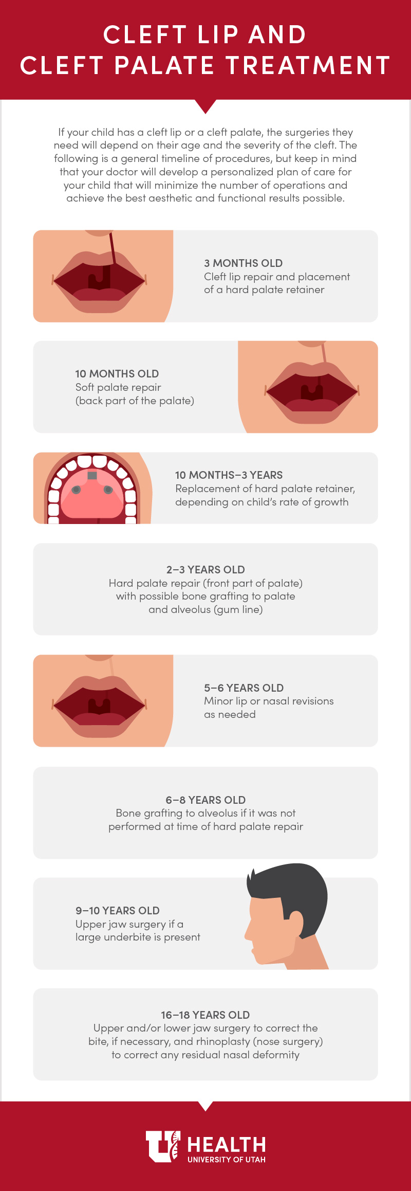 cleft lip and cleft treatment infographic