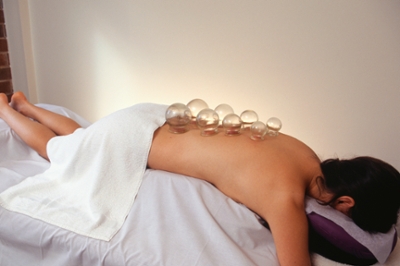 Cupping Accupuncture