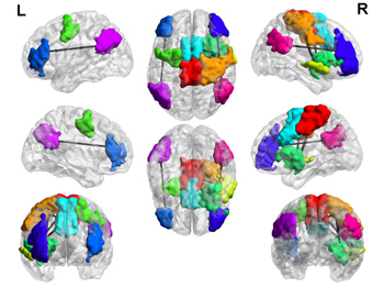 Wired for Gaming: Brain Differences Found in Compulsive Video Game Players