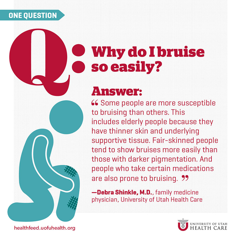 Why Bruise Infographic