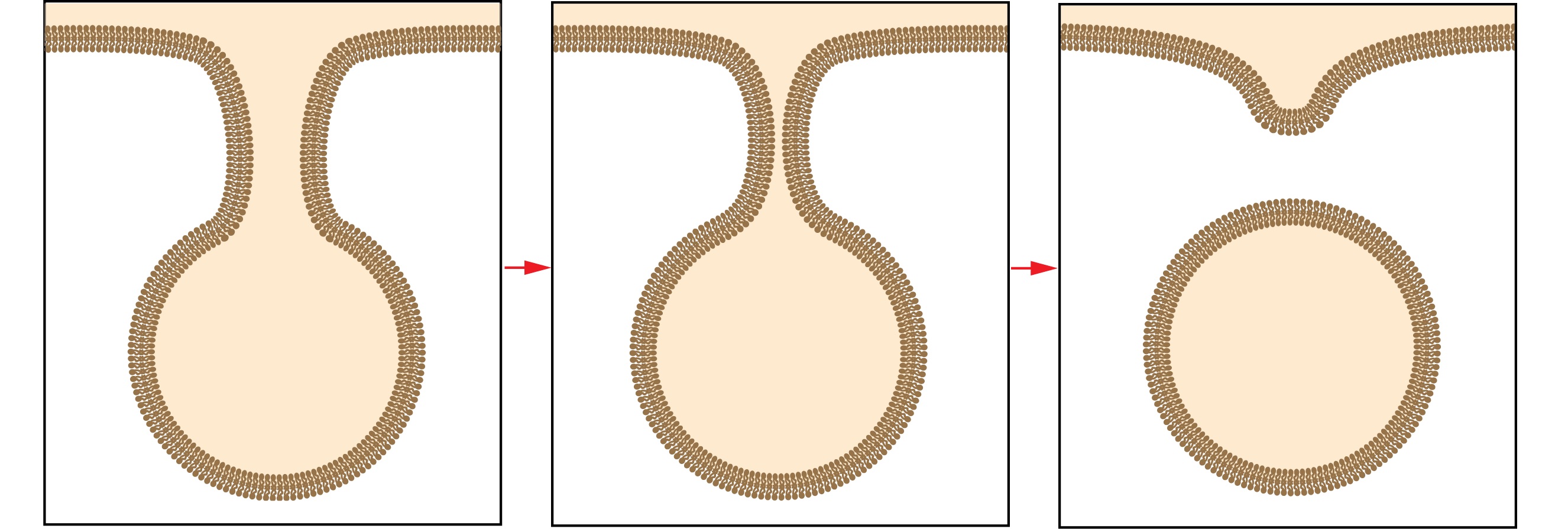 membrane pinching model