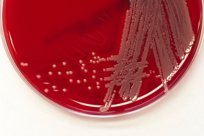 MRSA in a petri dish