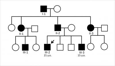 A family pedigree showing genetic patterns for osteoarthritis