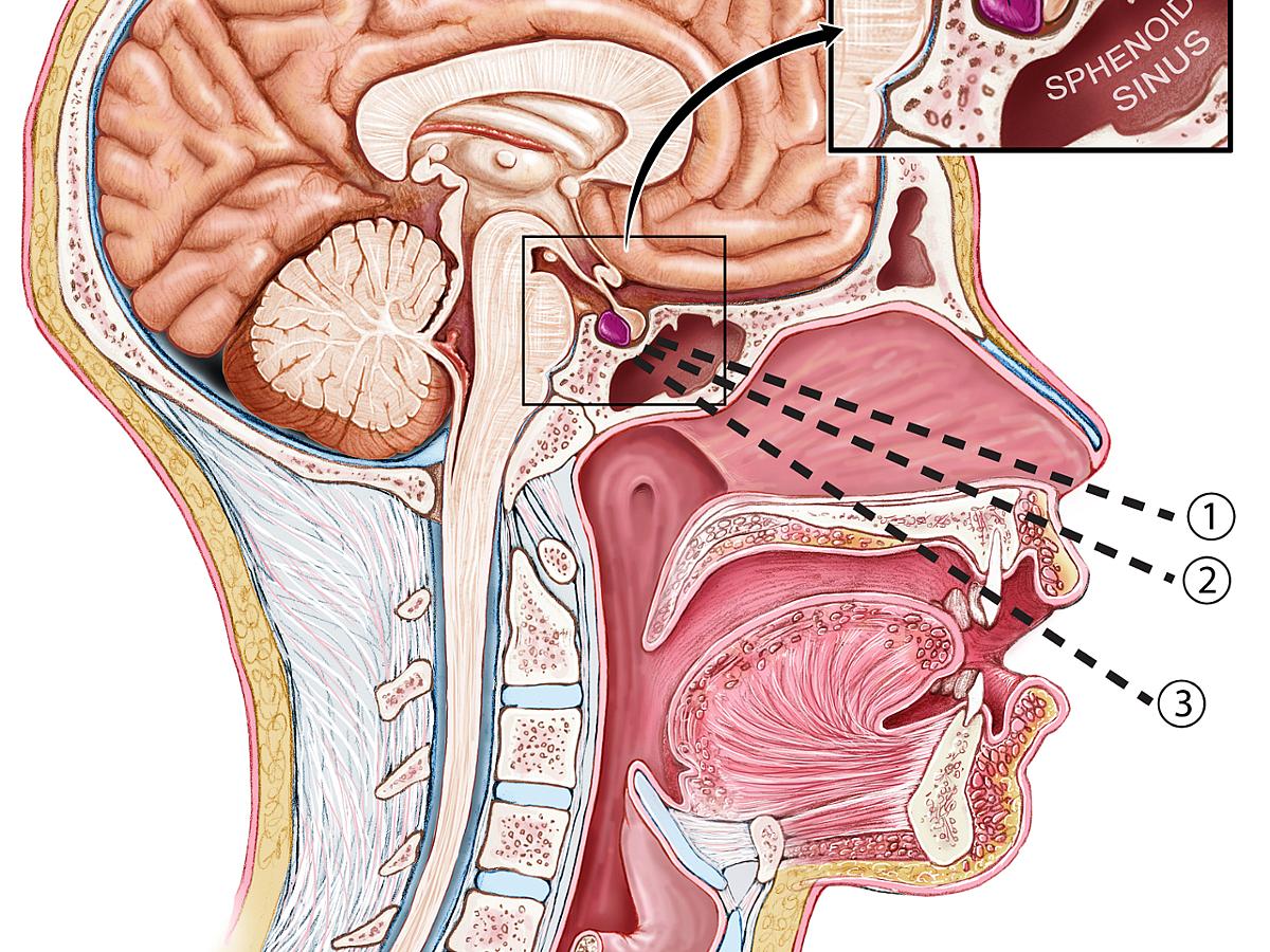 Medical illustration of a the brain and location of the pituitary tumor